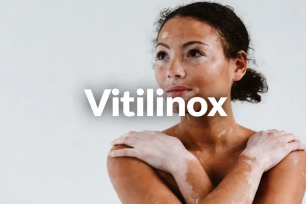 vitilinox